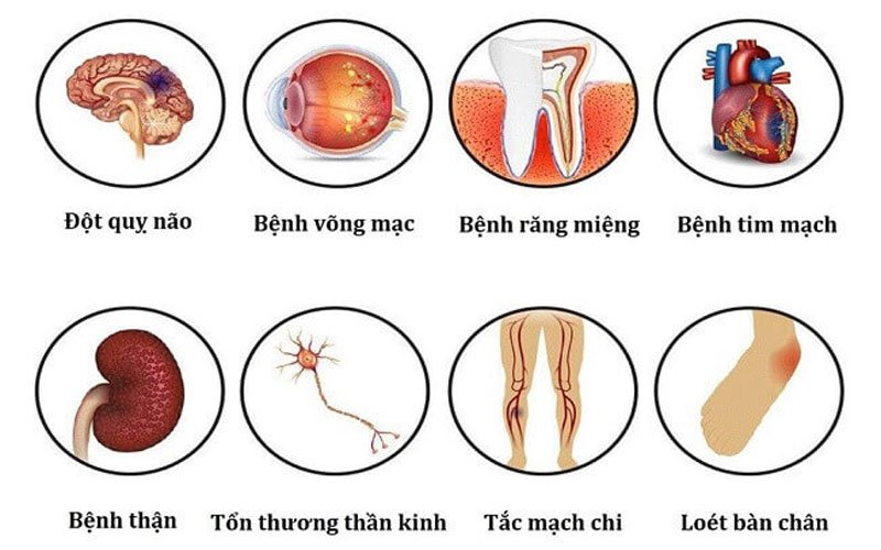 Biến chứng cơ xương khớp do tiểu đường