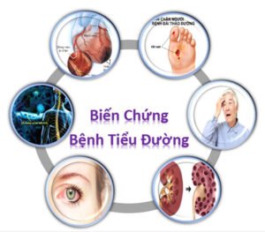 Biến chứng cơ xương khớp do tiểu đường